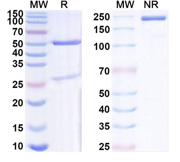 SDS-PAGE for Anti-QKI-7 Antibody (N183/15).