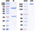 Anti-TAG-72 Reference Antibody (Satumomab) – Figure 1 of 1
