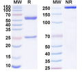 SDS-PAGE for Anti-Human TAG-72 Antibody (ACT19)