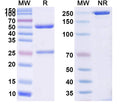Anti-Human TAG-72 Reference Antibody (CC49) – Figure 1 of 1