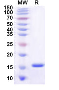 Recombinant Human SLC4A4 Protein, C-His