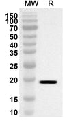 Western blot analysis was performed using anti-TMX2 polyclonal antibody at 1ug/mL on recombinant TMX2 (Catalog No. HP317012).