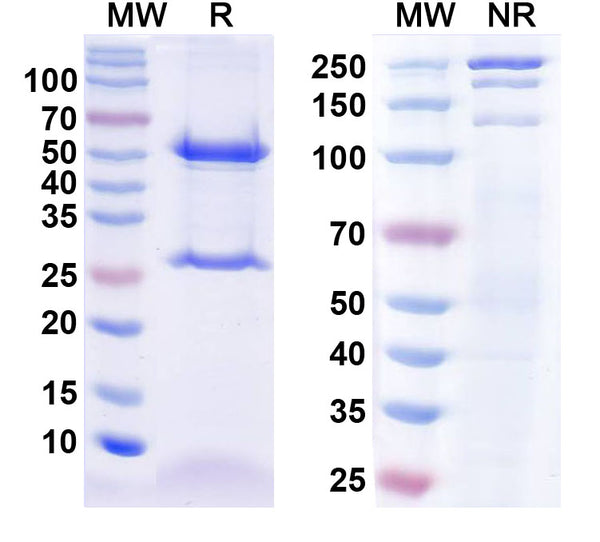 SDS-PAGE for Anti-Detyrosinated alpha tubulin antibody (1A046)