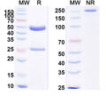 SDS-PAGE for Anti-Human SMYD2 IP Antibody (SAA0229)