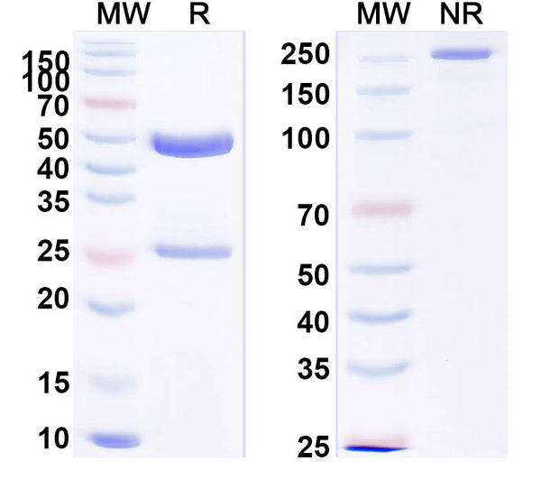 SDS-PAGE for Anti-Human SMYD2 IP Antibody (SAA0229)