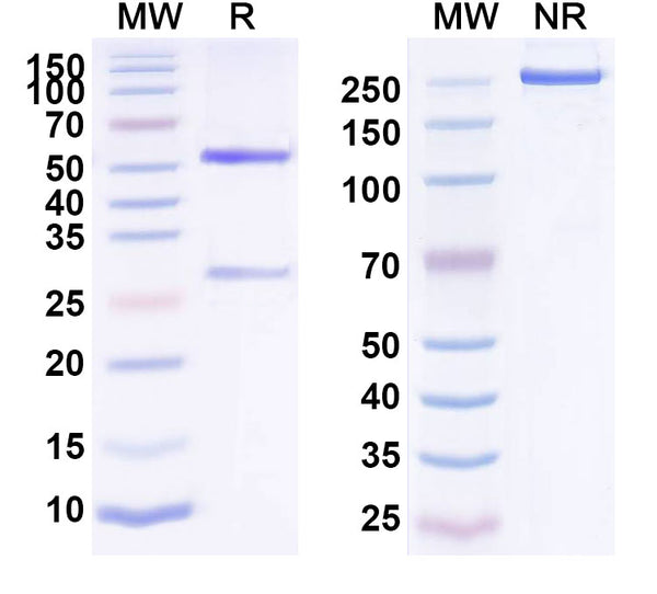 SDS-PAGE for Anti-Human RIOX1/C14ORF169 IP Antibody (SAA0194)