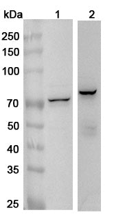 Western blot analysis was performed using anti-IGF2BP1 polyclonal antibody at 1μg/ml on various samples.
Lane 1: K562 cell lysate
Lane 2: 293T cell lysate