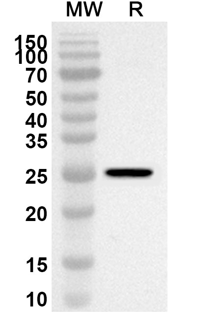 Western blot analysis was performed using anti-Human TWIST2 polyclonal antibody at 1ug/mL on recombinant Human TWIST2 (Catalog No. HP431012).