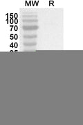 Western blot analysis was performed using anti-Human ANKRD6 polyclonal antibody at 1ug/mL on recombinant Human ANKRD6 (Catalog No. HP443012).