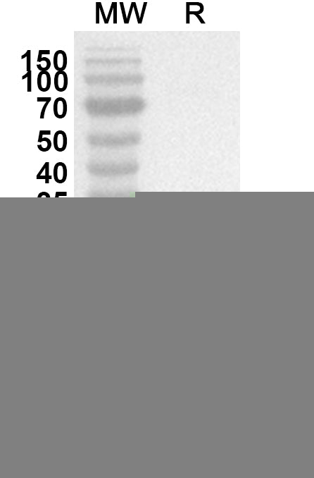 Western blot analysis was performed using anti-Human ANKRD6 polyclonal antibody at 1ug/mL on recombinant Human ANKRD6 (Catalog No. HP443012).