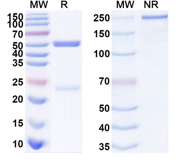 SDS-PAGE for Anti-Human ARID3A Antibody (SAA2127)