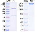 SDS-PAGE for Anti-Human CA19-9/CA199 Monoclonal Antibody (1A297)