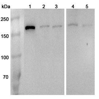 Western blot analysis was performed using anti-RPTOR polyclonal antibody at 1μg/ml on various samples.
Lane 1: NIH3T3 cell lysate
Lane 2: Hela cell lysate
Lane 3: 293T cell lysate
Lane 4: PC12 cell lysate