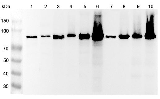 Western blot analysis was performed using anti-ACO2 polyclonal antibody at 1μg/ml on various samples.
Lane 1: Neuro-2a cell lysate
Lane 2: Jurkat cell lysate
Lane 3: Mouse brain lysate
Lane 4: Mouse kidney lysate
Lane 5: Mouse heart lysate
Lane 6: Rat brain lysate
Lane 7: Rat kidney lysate
Lane 8: Rat heart lysate