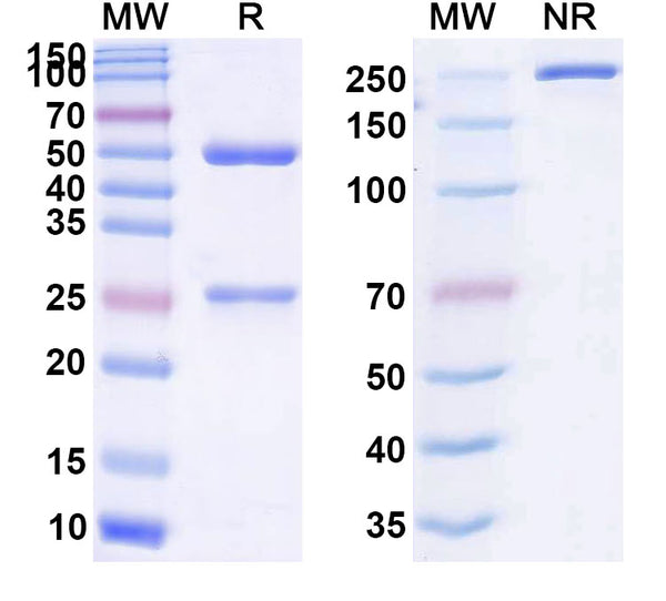 SDS-PAGE for Anti-Human ATAD2B IP Antibody (SAA0243)