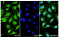 Hela cells were fixed with 4% paraformaldehyde for 20 minutes, followed by blocking with 5% goat serum for 1 hour. The cells were then incubated with a primary antibody targeting ADD3 (HP522014) at a concentration of 24 ug/ml overnight at 4°C. Afterward, the cells were incubated with a secondary antibody, Goat Anti-Rabbit IgG (Alexa Fluor-488) for 50 minutes at room temperature. The localization of ADD3 was visualized (shown in green), and nuclear DNA was stained with DAPI (shown in blue).