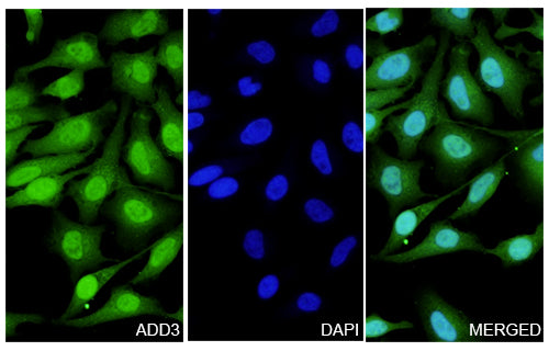 Hela cells were fixed with 4% paraformaldehyde for 20 minutes, followed by blocking with 5% goat serum for 1 hour. The cells were then incubated with a primary antibody targeting ADD3 (HP522014) at a concentration of 24 ug/ml overnight at 4°C. Afterward, the cells were incubated with a secondary antibody, Goat Anti-Rabbit IgG (Alexa Fluor-488) for 50 minutes at room temperature. The localization of ADD3 was visualized (shown in green), and nuclear DNA was stained with DAPI (shown in blue).