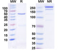 SDS-PAGE for Anti-CLN6 Antibody (N400/82)