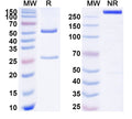 SDS-PAGE for Anti-Human Abeta40/Beta-APP40 Antibody (SAA1381).