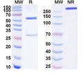 SDS-PAGE for Anti-Human SIRT5 Antibody (SAA2132)