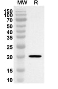 Western blot analysis was performed using anti-Human ASF1A polyclonal antibody at 1ug/mL on recombinant Human ASF1A (Catalog No. HP534012).