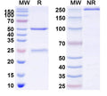 Anti-Human VISTA/B7-H5/PD-1H Reference Antibody (Solnerstotug) – Figure 1 of 1