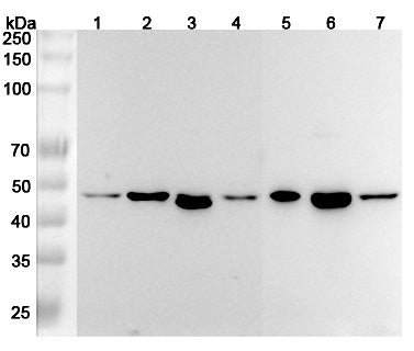 Western blot analysis was performed using anti-RSAD2 polyclonal antibody at 1μg/ml on various samples.
Lane 1: HUVEC cell lysate
Lane 2: Mouse spleen lysate
Lane 3: Mouse brain lysate
Lane 4: Mouse lung lysate
Lane 5: Rat spleen lysate
Lane 6: Rat brain lysate
Lane 7: Rat lung lysate