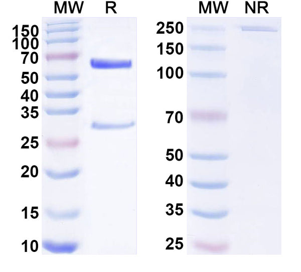 SDS-PAGE for Anti-Human BAZ2B IP Antibody (SAA0244).