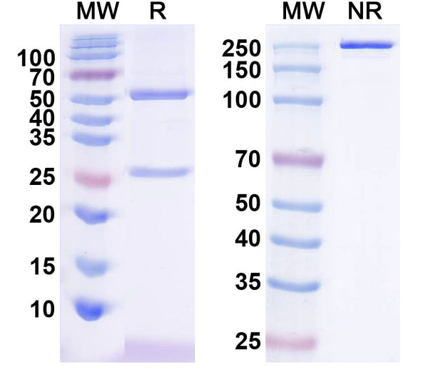 SDS-PAGE for Anti-Human JMJD6 IP Antibody (SAA0203)