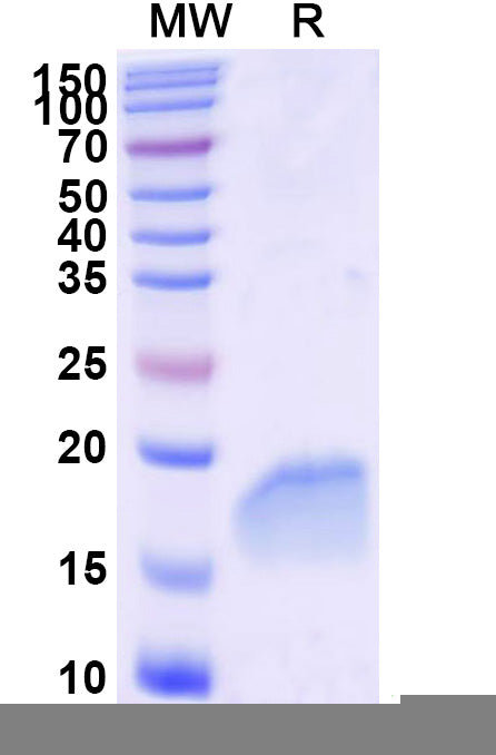 SDS-PAGE for Anti-Human CAVIN1 Nanobody (SAA2295)