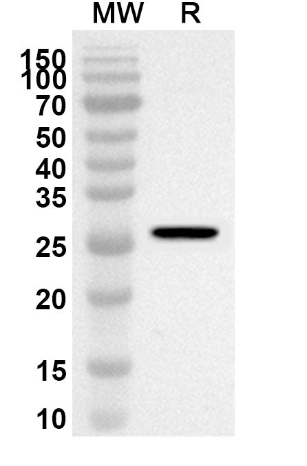 Western blot analysis was performed using anti-Human CAVIN1 polyclonal antibody at 1ug/mL on recombinant Human CAVIN1 (Catalog No. HP645012).