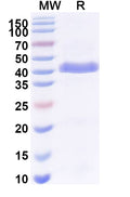 SDS-PAGE for Anti-human Pulmonary surfactant-associated protein A/SP-A Antibody (SAA2226).