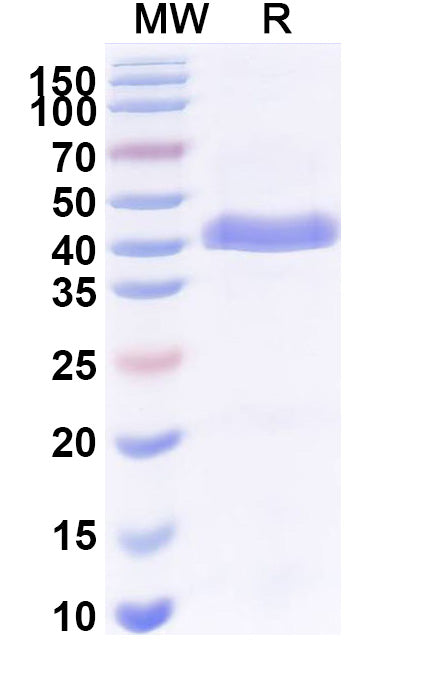 SDS-PAGE for Anti-human Pulmonary surfactant-associated protein A/SP-A Antibody (SAA2226).