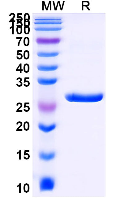 Recombinant Human SFTPA1 Protein, N-His-SUMO