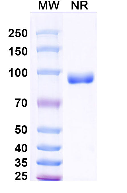 SDS-PAGE for Anti-human Pulmonary surfactant-associated protein A/SP-A Antibody (SAA2227)