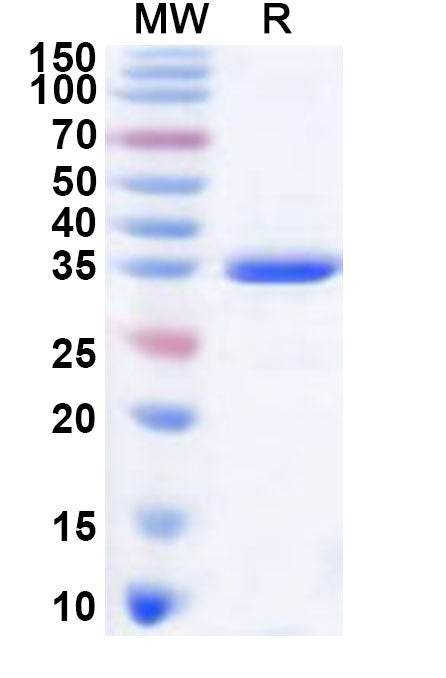 Recombinant Human KAAG1 Protein, N-GST & C-His