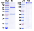 SDS-PAGE for Anti-Human CT83/KK-LC-1 Antibody (SAA1826)