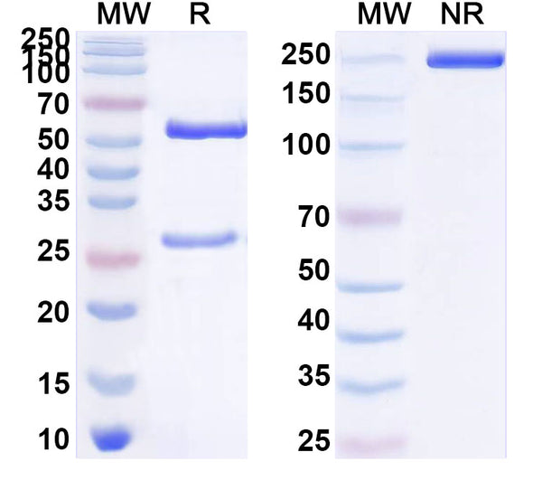 SDS-PAGE for Anti-Human D-Dimer Monoclonal Antibody (1A353)