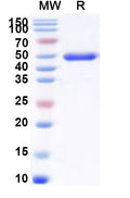 Recombinant Human SETD7 Protein, N-His