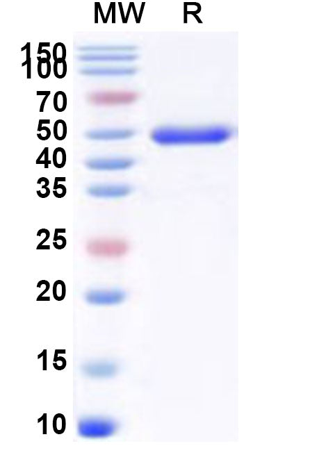 Recombinant Human SETD7 Protein, N-His