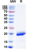 Recombinant Human CLEC2D/OCIL/LLT1 Protein, N-His