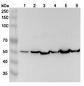 Western blot analysis was performed using anti-ACTL7A polyclonal antibody at 1μg/ml on various samples.
Lane 1: U87 cell lysate
Lane 2: NIH3T3 cell lysate
Lane 3: Mouse liver lysate
Lane 4: Mouse testis lysate
Lane 5: Rat liver lysate
Lane 6: Rat testis lysate