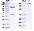 SDS-PAGE for Anti-Human TAFA5/FAM19A5 Antibody (SAA1465)