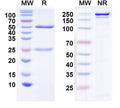 SDS-PAGE for Anti-NSD3 Antibody (N348/63)