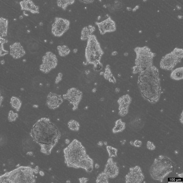 HROC147Met1 cell