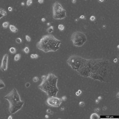 HROC395Met1 cell