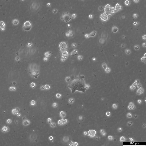 HROC450Met1 T0 M1 cell