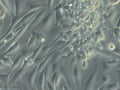 HROG17 T1 M1 cell