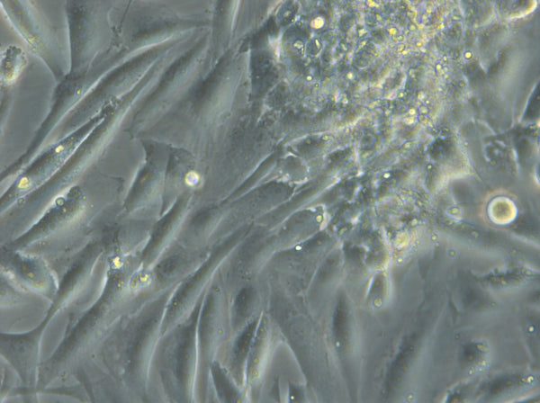 HROG17 T1 M1 cell