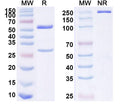 SDS-PAGE for Anti-Phospho-Smad2 (pT8) Antibody (P4.B9).
